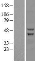 ZC3H10 Protein (Over-Expression Lysate Myc-DDK (Flag))