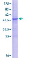 Human ULBP5 / RAET1G Protein (Recombinant GST)