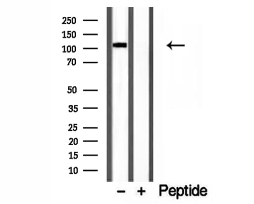 Polyclonal Rabbit anti-Human CYLD Antibody (IHC, WB)