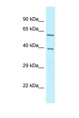 Polyclonal Rabbit anti-Human BAG4 / SODD Antibody (C-Terminus, WB)