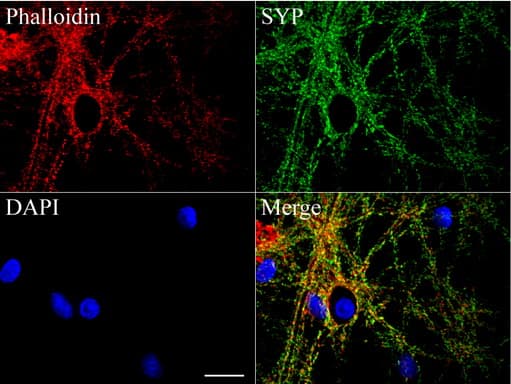 SYP / Synaptophysin Antibody (clone UMAB112)