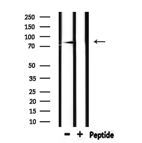 SCNN1B / ENaC Beta Antibody