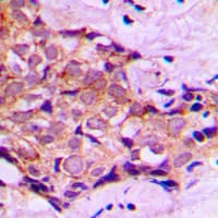 DNAL4 / Dynein Light Chain 4 Antibody (N-Terminus)