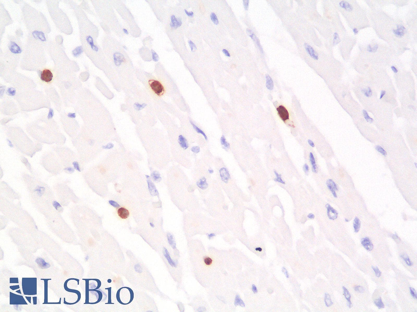 PathPlus™ FUT4 / CD15 Antibody (clone FUT4/1478R)