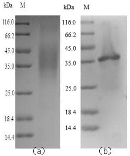 Human LGMN / Legumain Protein (Recombinant 6His, N-terminus)