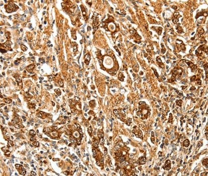 Polyclonal Rabbit anti-Human FSH Receptor / FSHR Antibody (IHC, WB)