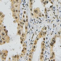 TBX1 Antibody (C-Terminus)