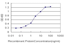 CENPJ / LAP Antibody (clone 5D5)