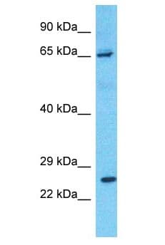 PRLR / Prolactin Receptor Antibody (aa254-303)