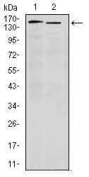 Monoclonal Mouse anti-Human ITGA4 / VLA-4 / CD49d Antibody (clone 5C4, WB)