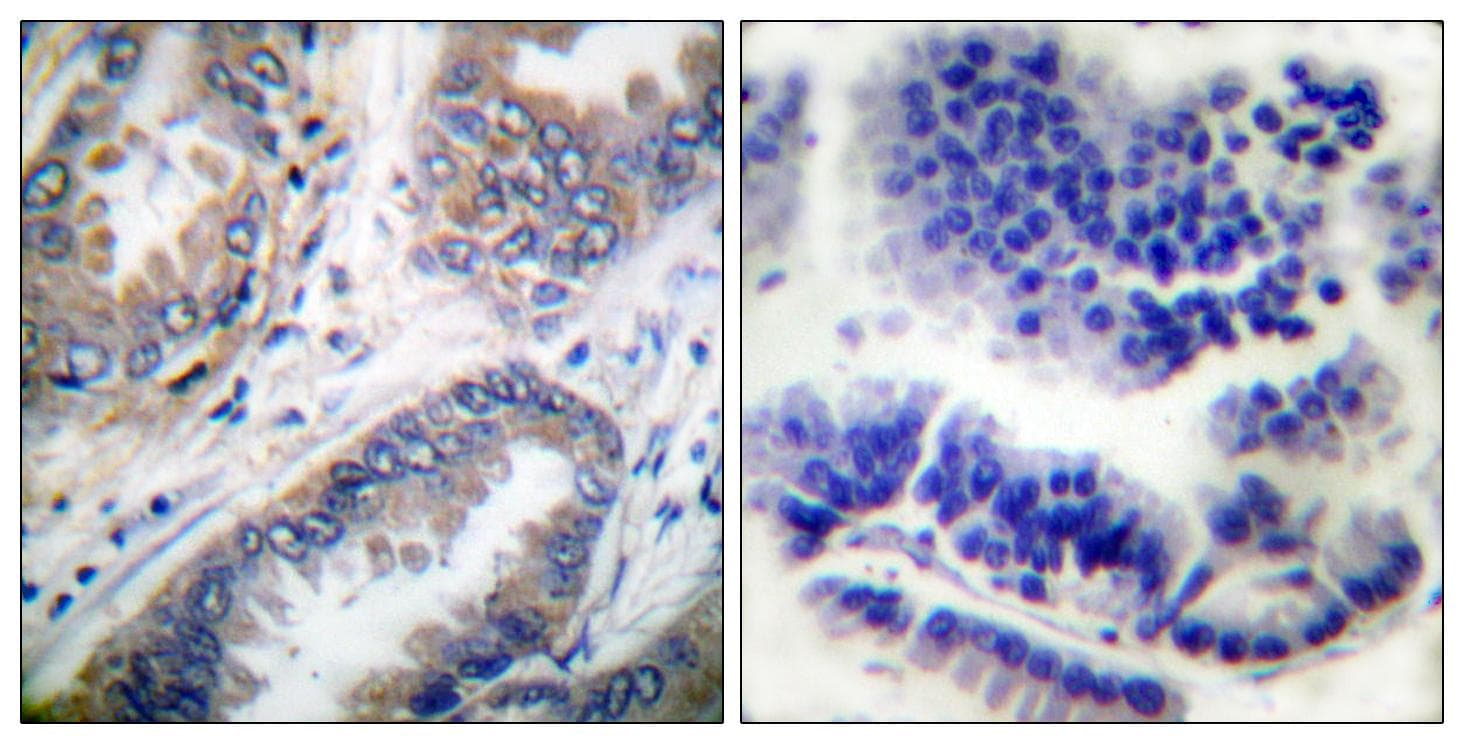 Polyclonal Rabbit anti-Human CASP9 / Caspase 9 Antibody (p125, IHC, IF, WB)