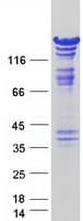 Human SMARCC2 Protein (Recombinant Myc-DDK (Flag))