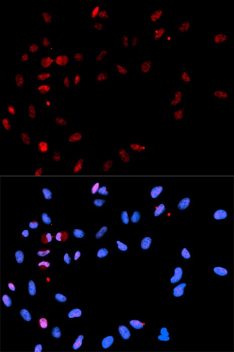 Histone H2A.X Antibody (phospho-Ser139)