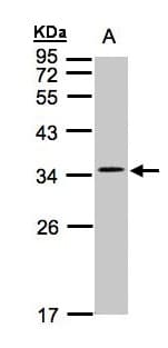 IHC-plus™ CACNG5 Antibody