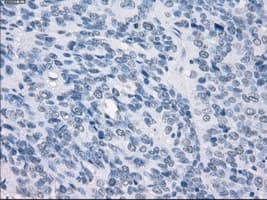 Monoclonal Mouse anti-Human GBP2 Antibody (clone OTI1E5, IHC, IF, WB)