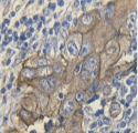 Monoclonal Mouse CA125 Antibody (clone 325, WB)
