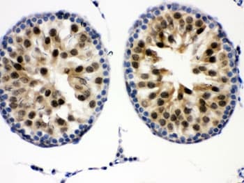 Polyclonal Rabbit anti-Human CDK2 Antibody (IHC, WB)