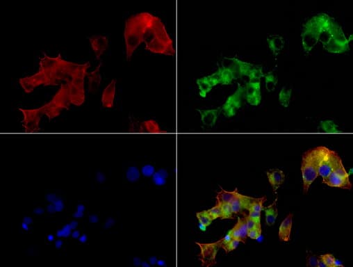 Alpha-Fetoprotein Antibody (clone UMAB66)