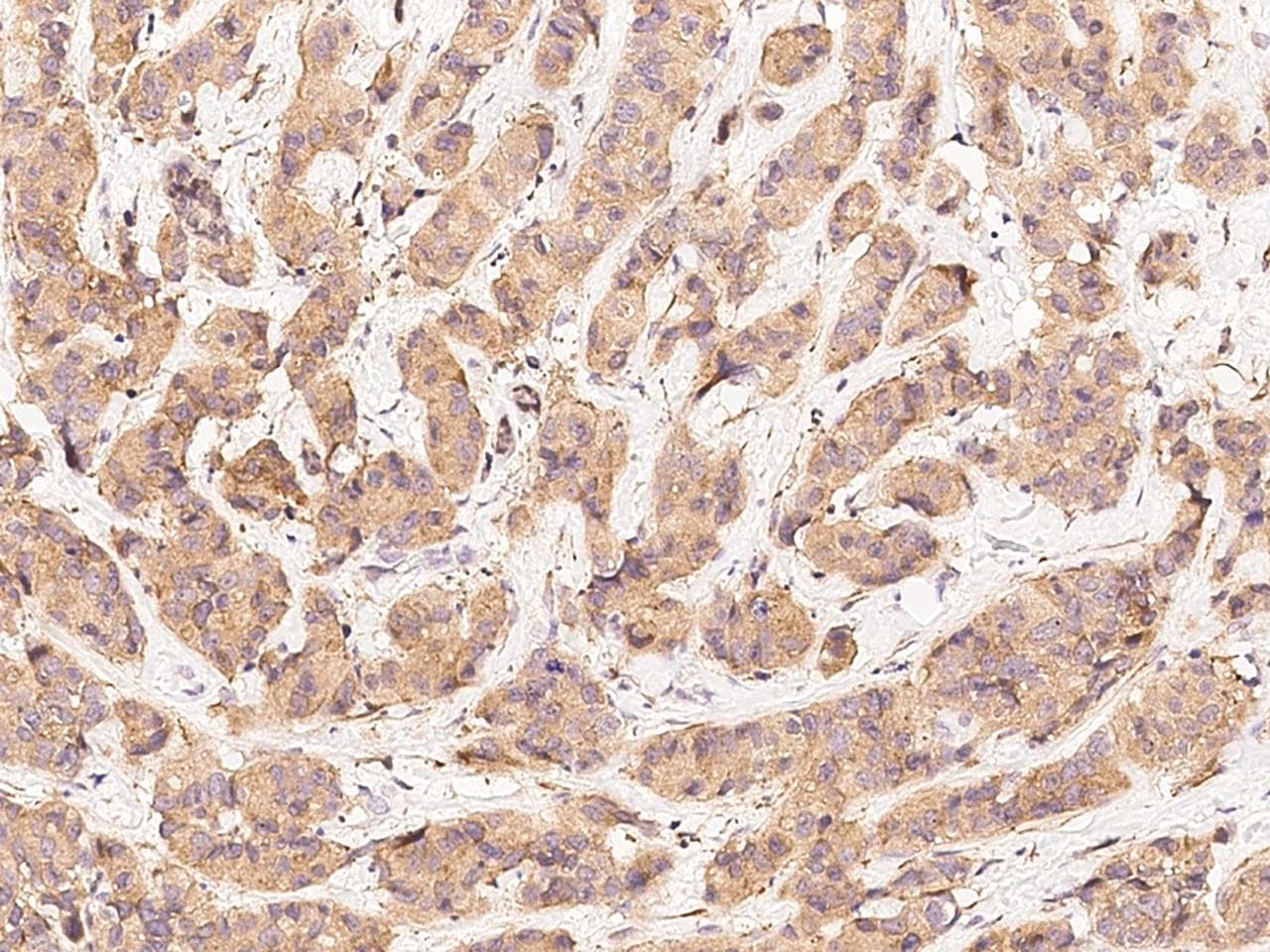 ERBB3 / HER3 Antibody (Preservative Free)