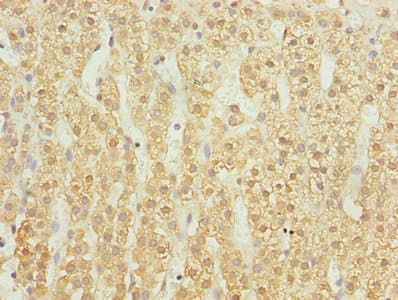 Polyclonal Rabbit anti-Human UBASH3B / STS-1 Antibody (IHC)