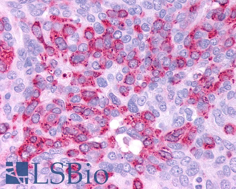 PathPlus™ Polyclonal Rabbit anti-Human GLP1R / GLP-1 Receptor Antibody (N-Terminus, IHC)