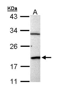 Polyclonal Rabbit anti-Human BCL2L15 Antibody (aa1-163, IHC, WB)