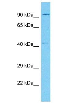 TMOD2 / Tropomodulin 2 Antibody (aa114-163)