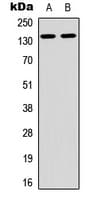 ARHGAP20 Antibody (Internal)
