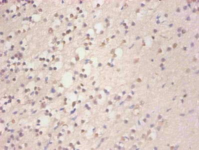 FTL / Ferritin Light Chain Antibody
