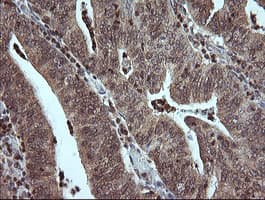 MAP2K3 / MEK3 / MKK3 Antibody (clone OTI6F8)