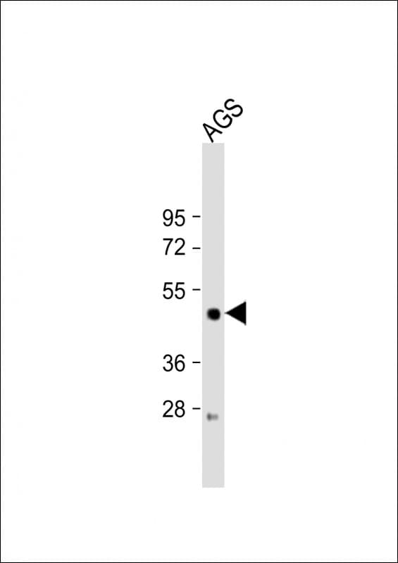 Polyclonal Rabbit anti-Human LIPF / GL / Gastric Lipase Antibody (aa243-276, WB)