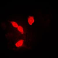 IHC-plus™ Polyclonal Rabbit anti-Human HNRPA1 / HnRNP A1 Antibody (Internal, IHC, IF, WB)