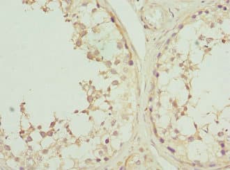 Polyclonal Rabbit anti-Human CSNK1G2 / CKI-Gamma 2 Antibody (IHC, WB)