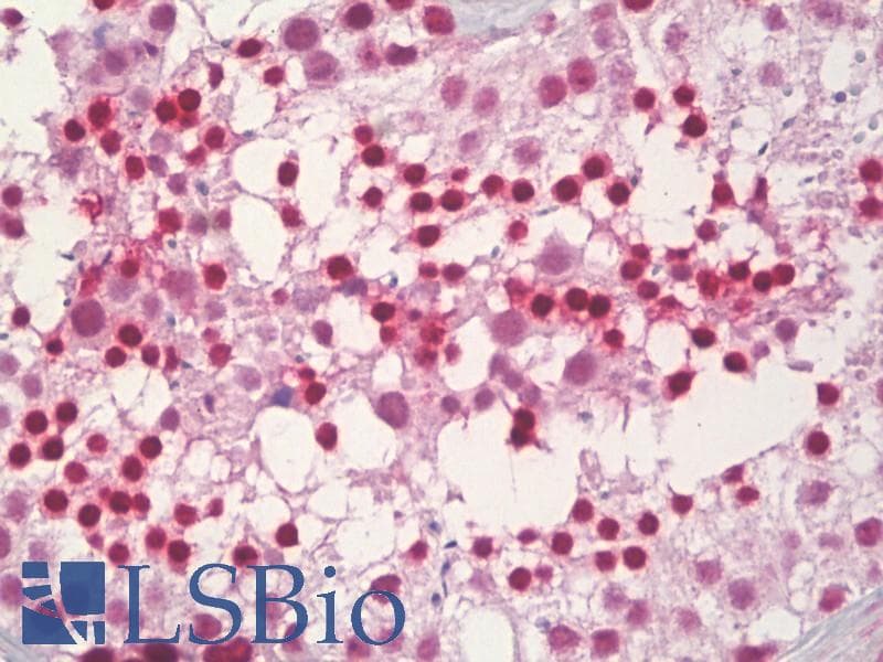 IHC-plus™ POLB / DNA Polymerase Beta Antibody (aa286-335)