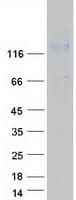 Human SEZ6 / SEZ-6 Protein (Recombinant Myc-DDK (Flag))