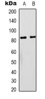 PIK3R1 / p85 Alpha Antibody