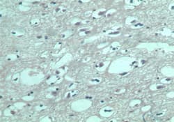 Polyclonal Rabbit anti-Human S1PR5 / EDG8 / S1P5 Antibody (IHC, WB)