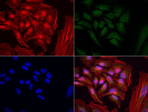 Monoclonal Mouse anti-Human MRPS34 Antibody (clone UMAB125, IHC, IF, WB)