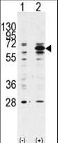 BECN1 / Beclin-1 Antibody (aa181-210)