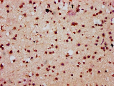 Polyclonal Rabbit anti-Human HIST1H2AI Antibody (IHC)