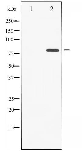 PRKCZ / PKC-Zeta Antibody (phospho-Thr560)