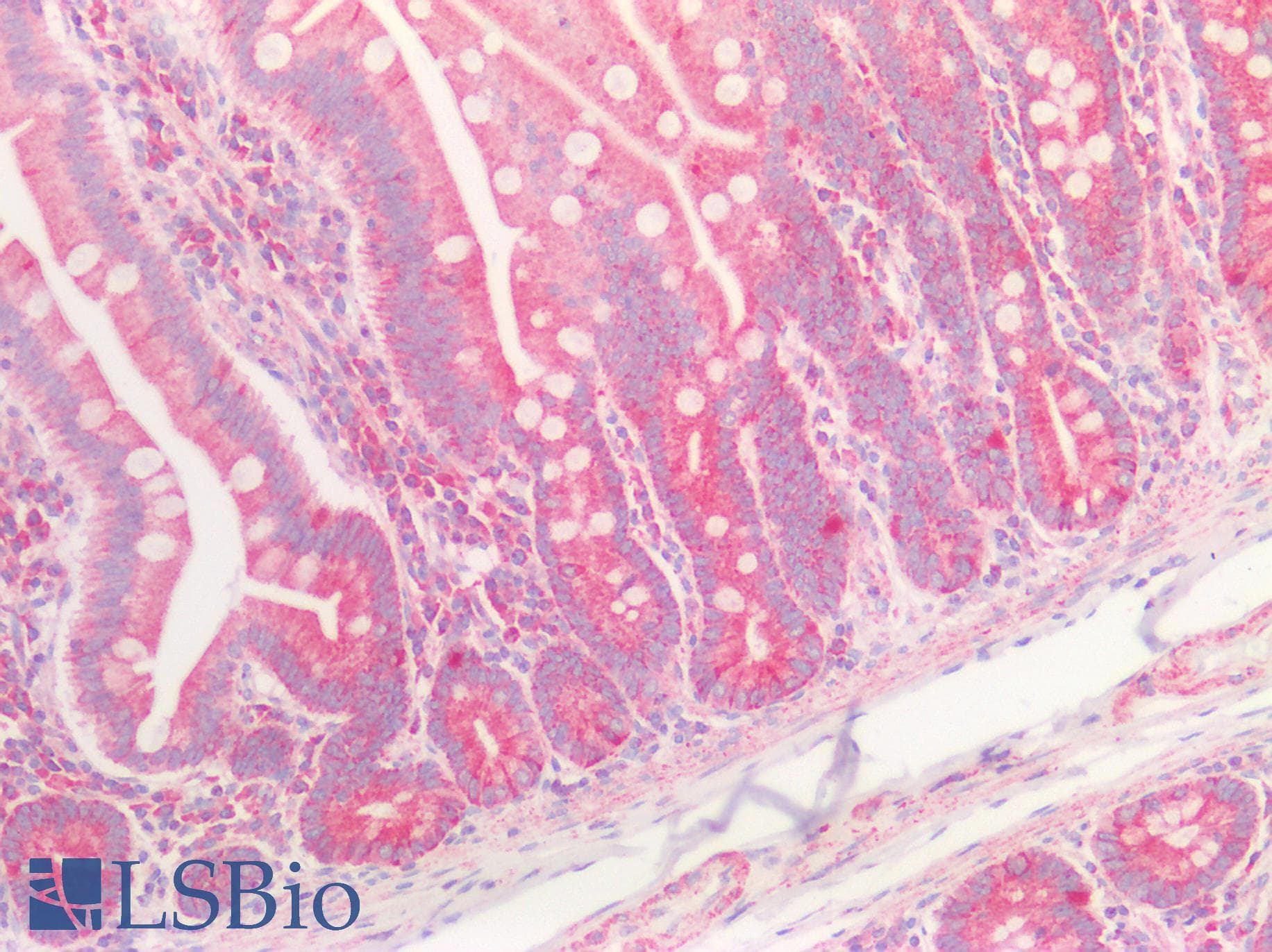 IHC-plus™ HFE Antibody