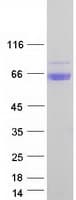 Human ARSA / Arylsulfatase A Protein (Recombinant Myc-DDK (Flag))