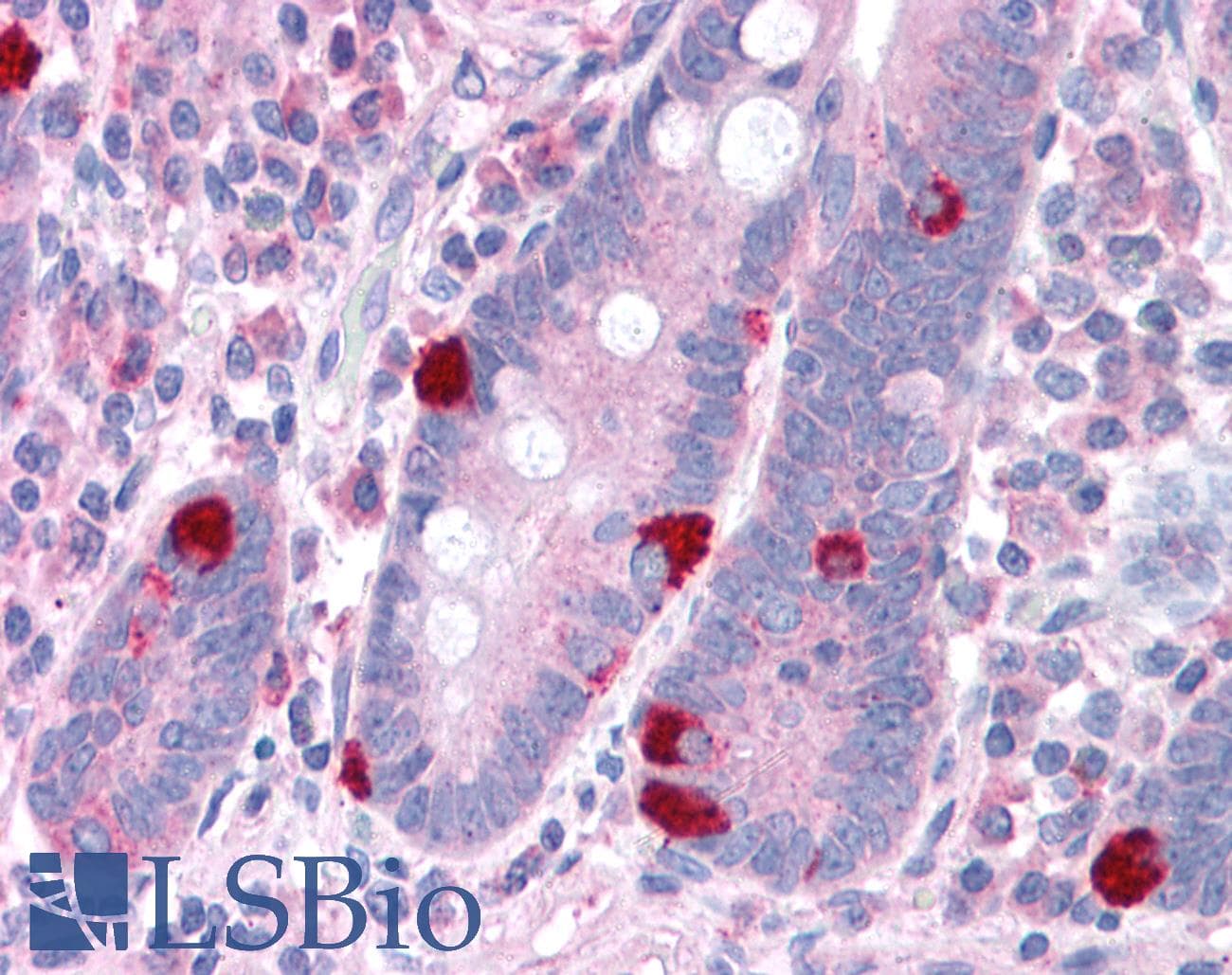 IHC-plus™ CADPS Antibody