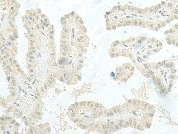 XTP4 / C17orf37 Antibody