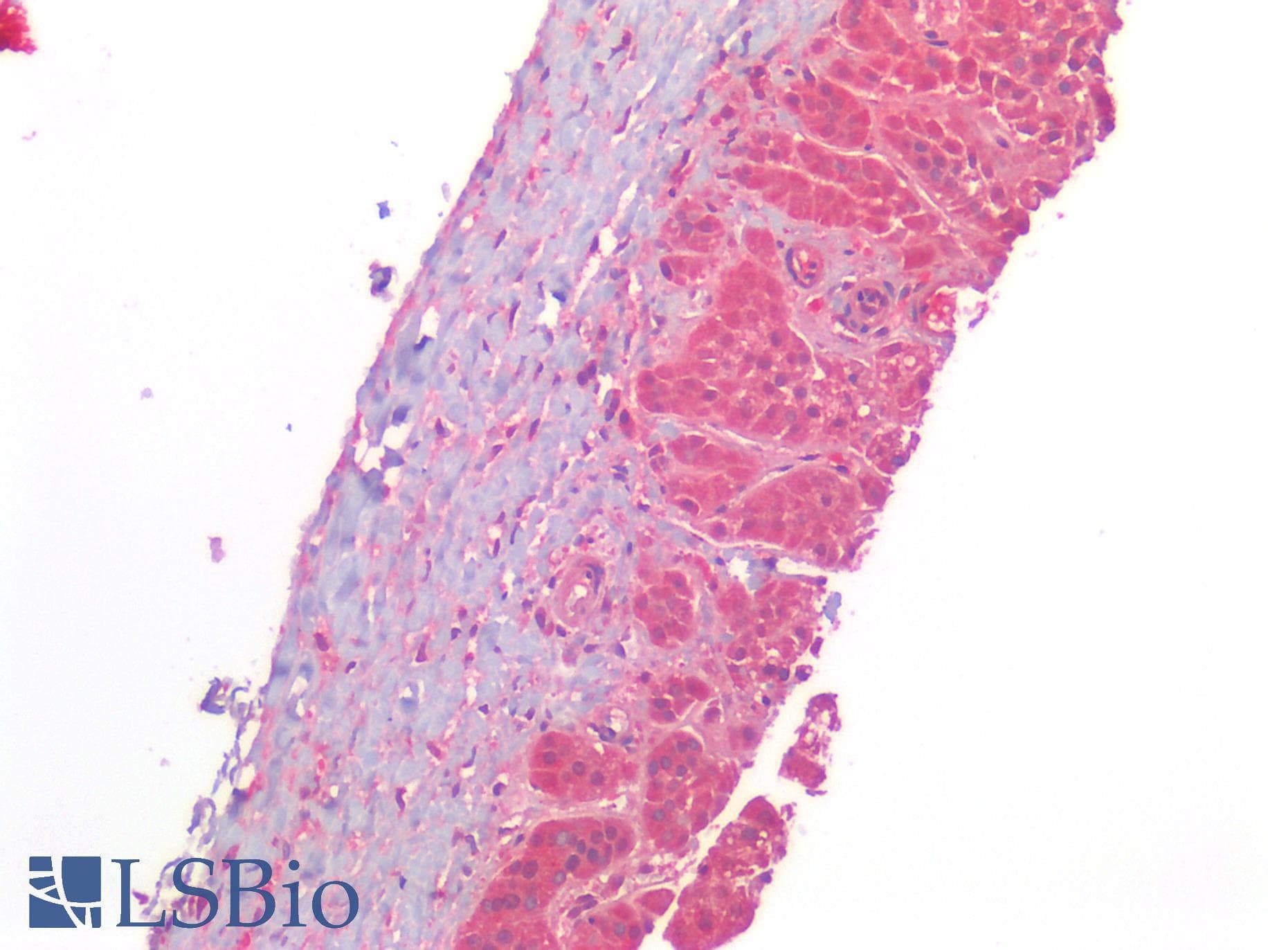 IHC-plus™ AGTR2 / AT2 Receptor Antibody (Internal)