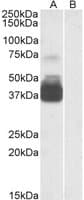 IHC-plus™ P2RX7 / P2X7 Antibody (aa13-26)