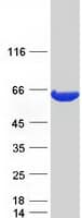 Human ACOT12 Protein (Recombinant Myc-DDK (Flag))