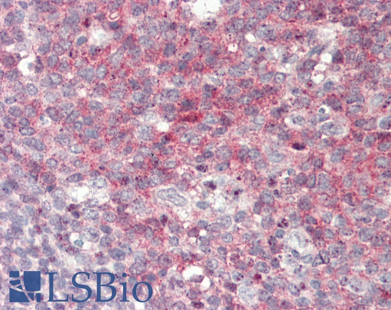 IHC-plus™ AKT2 Antibody (aa93-122)