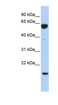 Polyclonal Rabbit anti-Human PTP4A3 Antibody (C-Terminus, WB)